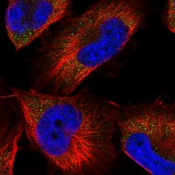 Aminopeptidase P1/XPNPEP1 Antibody, Novus Biologicals:Antibodies:Primary